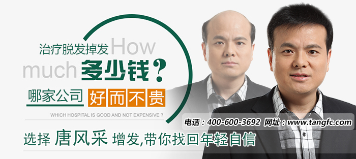 頭頂頭發(fā)稀疏怎么辦？怎樣可以防止脫發(fā)？