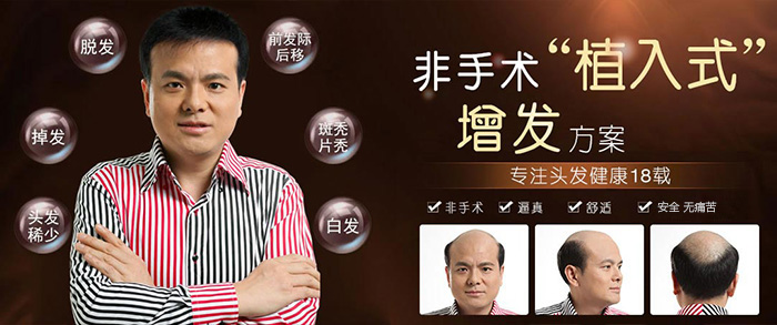 包頭男士假發(fā)首選唐風采 脫發(fā)不僅是形象問題