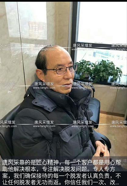 大爺大叔傻傻分不清楚？——唐風(fēng)采增發(fā)案例展示