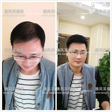 如何避免成為一個脫發(fā)的中年猥瑣男人？